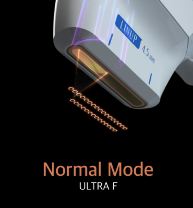 Ultra F 探頭接觸面及超聲波輸出模式