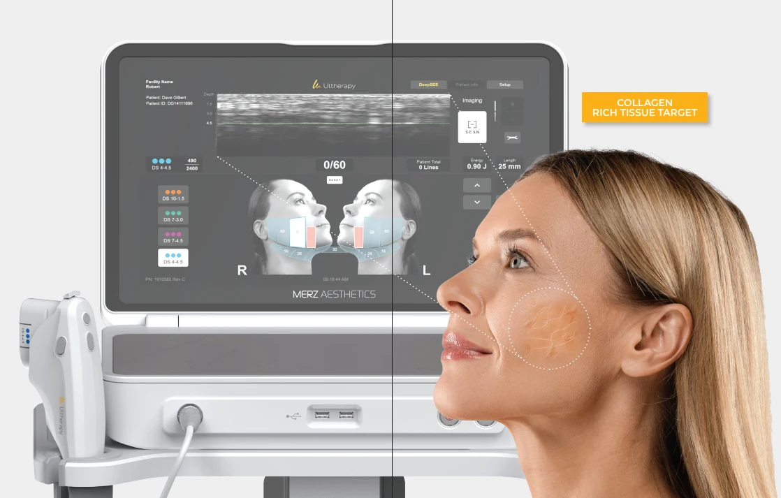 同時確認 DeepSEE 即時影像與肌膚結構的 Ultherapy Prime 說明圖片